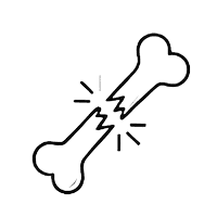 Перелом